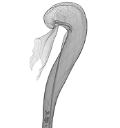 X-Ray of the Darlingtonia